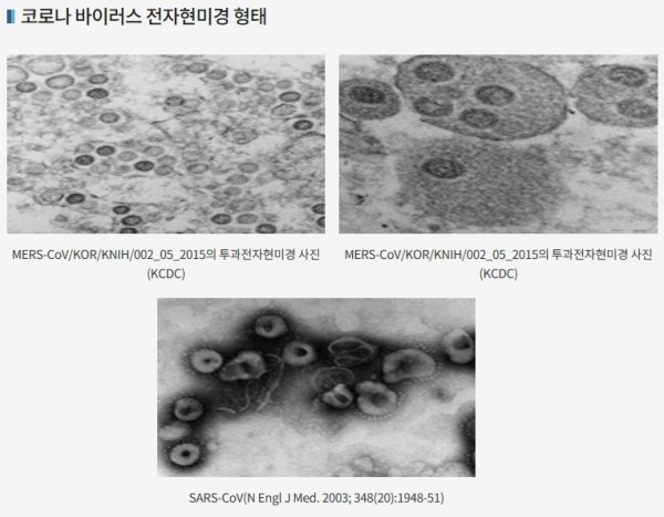 출처: 질병관리본부