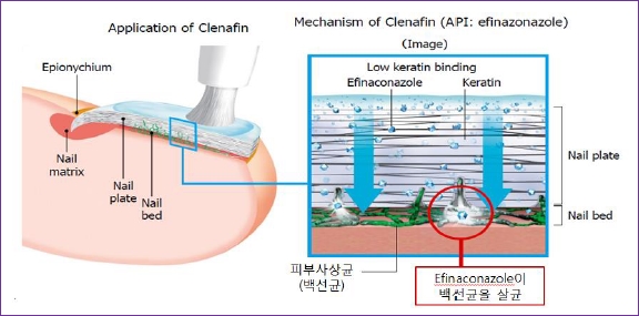 손발톱 구조 및 주블리아 도포 과정